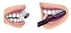 Fogmosás lépéseit bemutató rajz.