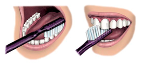 Fogmosás lépéseit bemutató rajz.